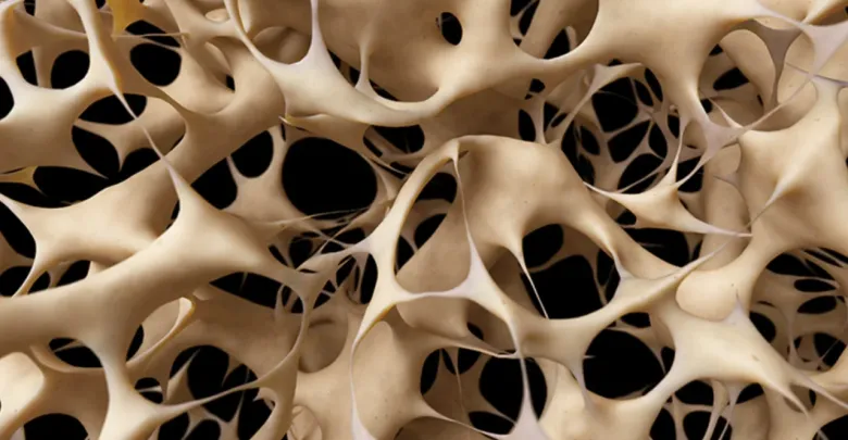 Osteoporoza,shkatërruesja e heshtur e kockave në organizmin njerëzor